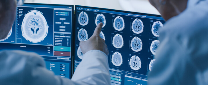 Doctors reviewing brain scans that show a brain hemorrhage