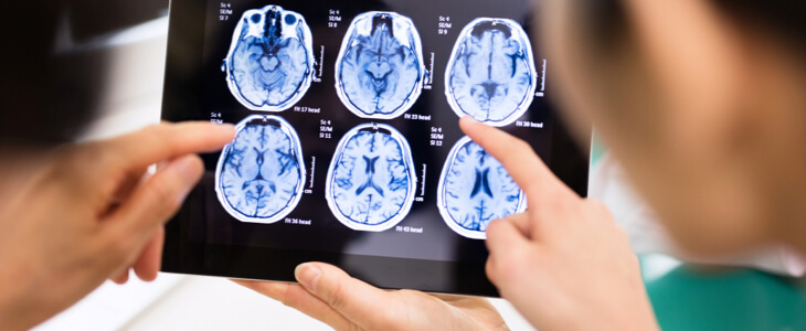 Doctors discussing brains scans after patient suffered a concussion