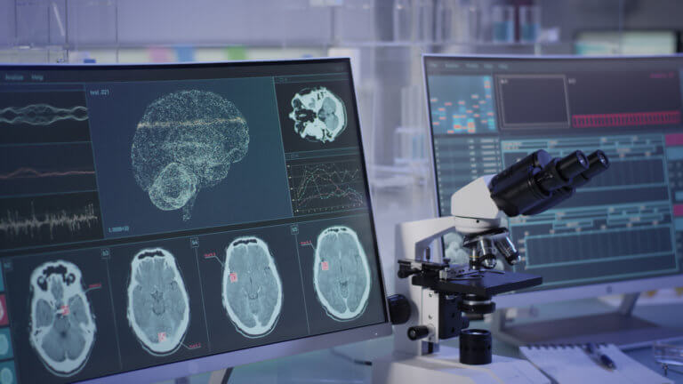 brain scan of TBI
