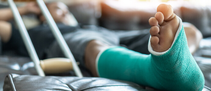 male patient with splint cast and crutches during surgery rehabilitation, orthopedic injury