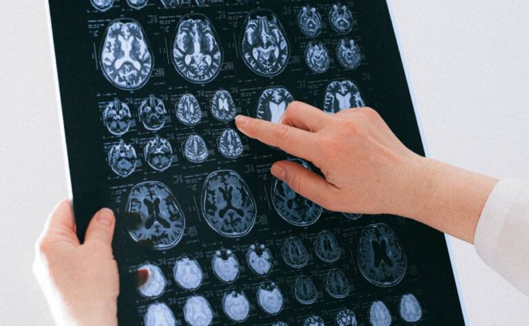 fingers pointing at brains on an xray