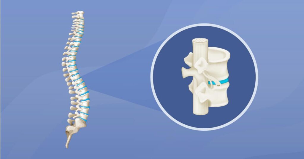 Classification of Spinal Cord Injuries